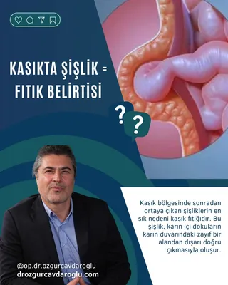 Kasıkta şişlik fıtık belirtisi mi