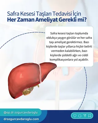 Safra taşı belirtileri nelerdir