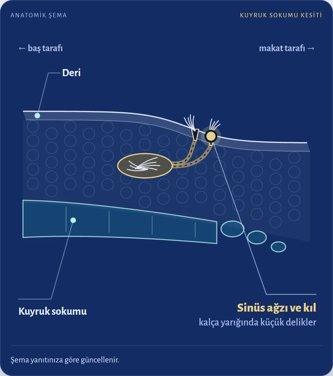 Kuyruk sokumu ağrısı kıl dönmesi mi