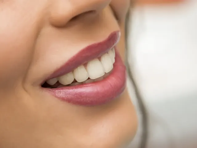 Gülüş Tasarımı — Habibler Clinic