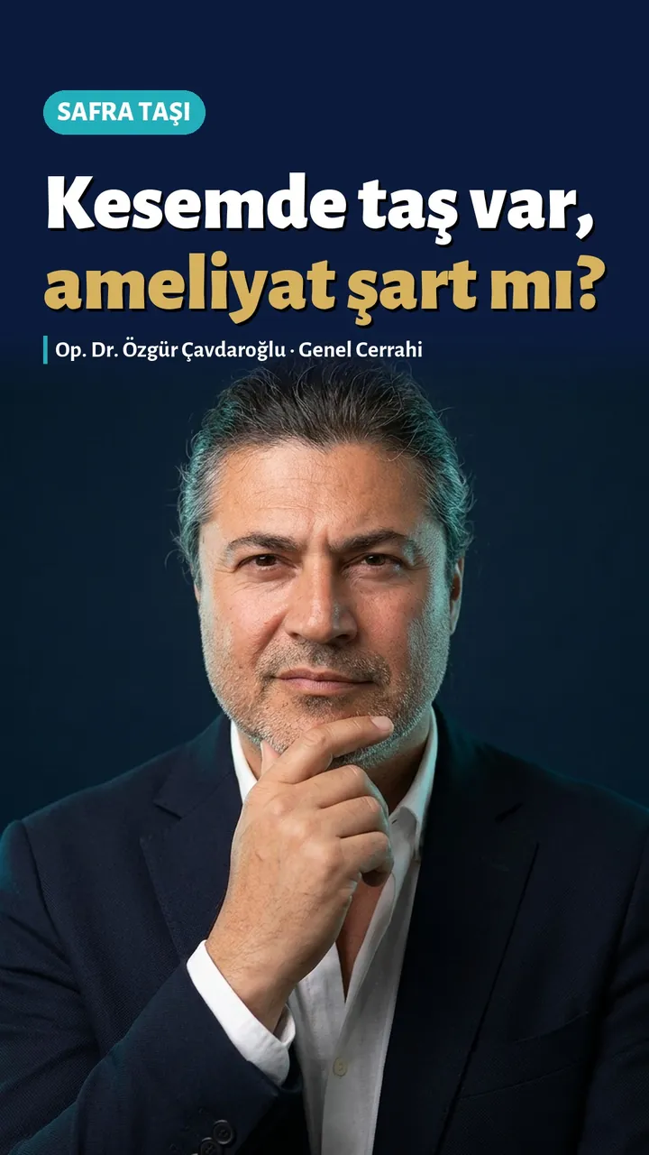 Safra kesesinde taş var ameliyat şart mı